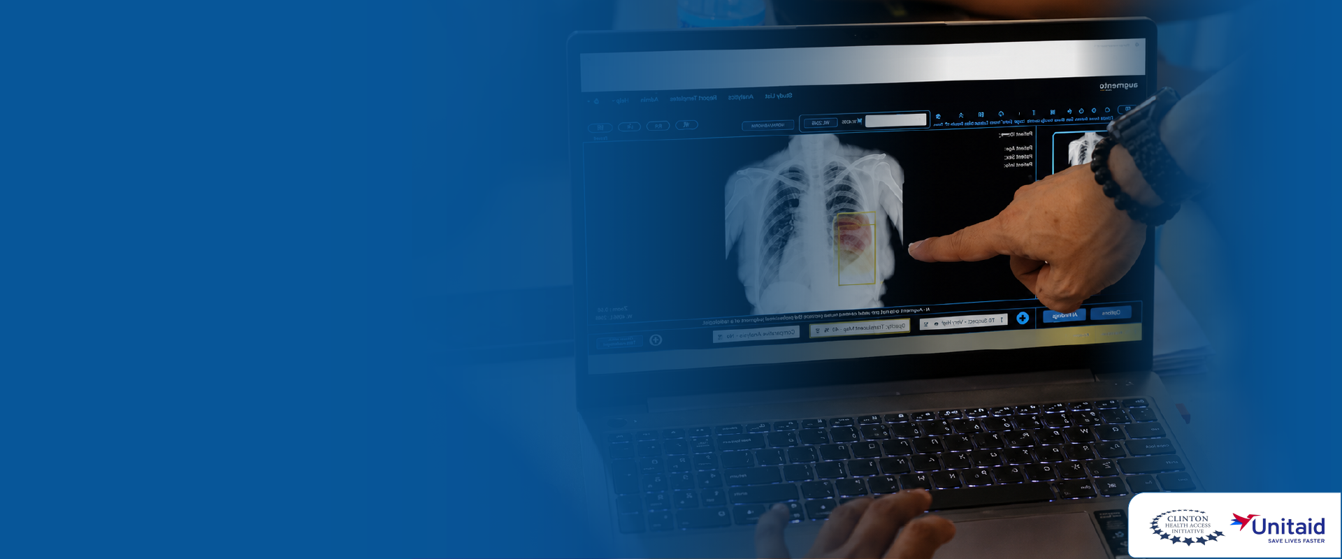AI solutions for transforming Radiology Workflow 